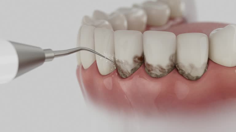 Reliable Emergency Dentist contractor in Tulsa, OK by Smile Center Dentistry